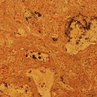 Пробка настенная Egen Atlanta Red